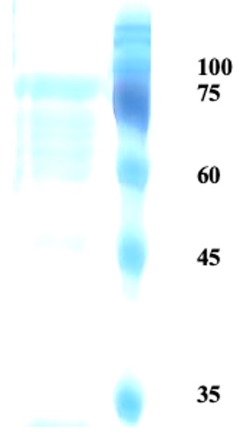Herpes simplex virus Type 2 (HSV-2) glycoprotein G Herpes simplex virus Type 2 (HSV-2) glycoprotein G