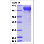 Human VEGFR2 / Flk-1 / CD309 / KDR Protein (Domain 1&2&3, Fc Tag)