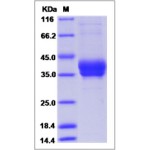 Human VEGFR2 / Flk-1 / CD309 / KDR Protein (Domain 2&3, His Tag)