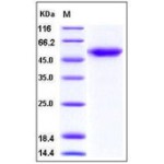 Human ALK-1 / ACVRL1 Protein (Fc Tag)