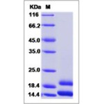 Human CCL2 / MCP-1 / MCP1 Protein (His Tag)
