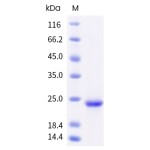 Human FGF7 / FGF-7 / KGF Protein (His Tag)