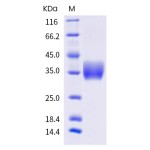 Human Galectin 3 / LGALS3 Protein (His Tag)