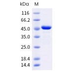 Human Galectin 3/LGALS3 Protein (GST Tag)