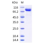 Human CD4 Protein (Fc Tag)