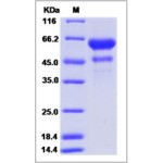 Human VEGF-B / VEGFB Protein (Fc Tag)