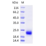 Human VEGF-D / VEGFD / FIGF Protein (His Tag)