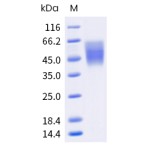 Human CD86 / B7-2 Protein (His Tag)