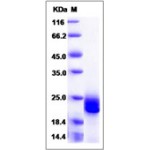 Human Interferon beta / IFN-beta / IFNB Protein