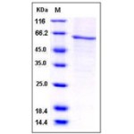 Human AKT1 / PKB / PKBα Protein (His Tag)