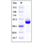 Human AKT3 Protein (GST Tag)