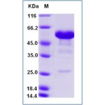 Human CD40 / TNFRSF5 Protein (Fc Tag)