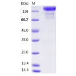 Human VEGFR3 / FLT4 Protein (ECD, Fc Tag)