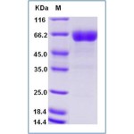 Human CD200 Protein (Fc Tag)