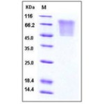 Human CCL5 / RANTES Protein (His & mucin Tag)