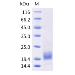 Human TIGIT Protein (His Tag)