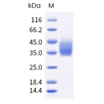 Human TIGIT / VSTM3 Protein (His Tag)