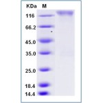 Human CEACAM5 / CD66e Protein (Fc Tag)