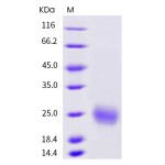 Human CTLA4 / CD152 Protein (His Tag), Biotinylated