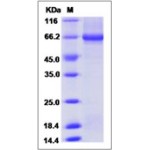 Human Alkaline phosphatase / ALPP Protein (His Tag)