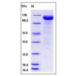 Human Alkaline Phosphatase / ALPI  Protein (Fc Tag)