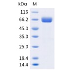 Human Alkaline Phosphatase / ALPI  Protein (His Tag)