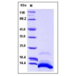 Human CXCL12 / SDF-1 Protein (isoform a, His Tag)