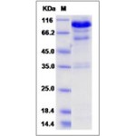 Mouse HGF / Hepatocyte Growth Factor Protein (His Tag)