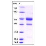 Mouse VEGF-D / VEGFD / FIGF Protein (Fc Tag)