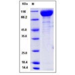 Mouse VEGFR2 / Flk-1 / CD309 / KDR Protein (His Tag)