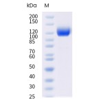 Mouse VEGFR1 / FLT-1 Protein (ECD, His Tag)