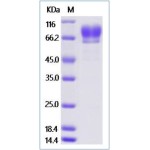 Mouse CD30 / TNFRSF8 Protein (ECD, Fc Tag)