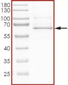 AKT1 (E17K), Active