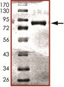 AKT3, Active