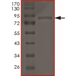 AKT3 (G171R), Active