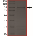 ALK (C1156Y), Active