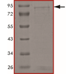 ALK (F1174S), Active