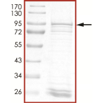 ALK (T1151_L1152insT), Active