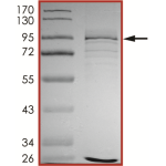ALK (G1202R), Active