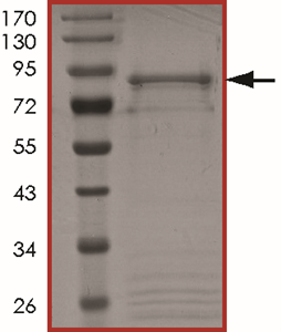 ALK (G1269A), Active