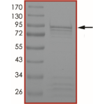 ALK (R1275Q), Active