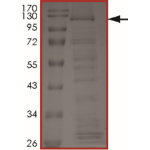KIAA1549-BRAF (Kex15Bex9), Active