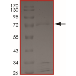 FAM131B-BRAF (Fex2Bex9), Active