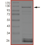 SRGAP3-BRAF (Sex12Bex9), Active