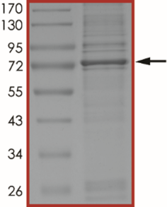BTK (R562P) Protein