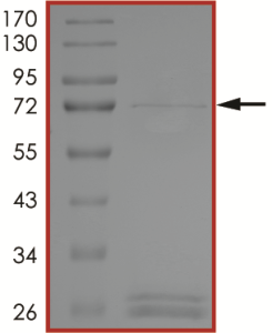 BTK (T474I), Active