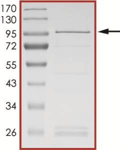 BTK (R562W) Protein