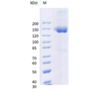 Recombinant Human CD70 