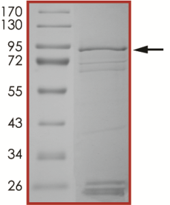 EGFR (P772_H773insNP) Protein