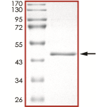 EGFR (V948R), Active